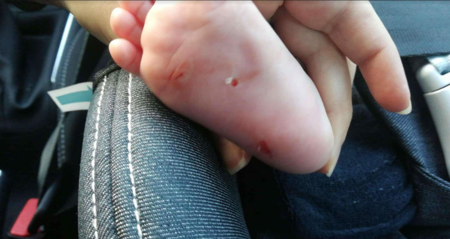 Σοκ από γυναίκα που πλησίασε και χαράκωσε μωρό στα νότια προάστια 