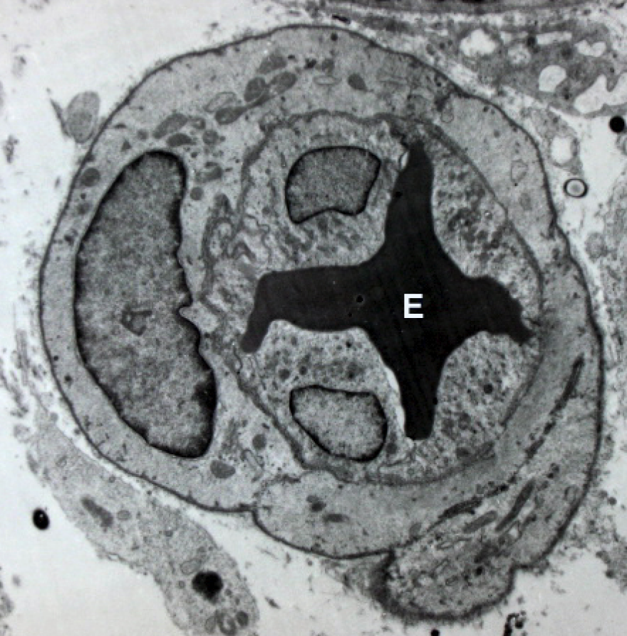 Δημιουργήθηκαν για πρώτη φορά στο εργαστήριο τέλεια ανθρώπινα αιμοφόρα αγγεία