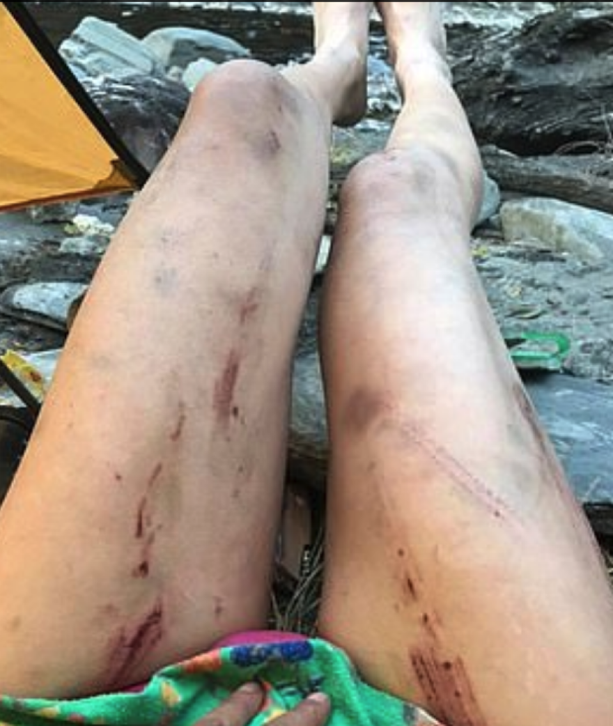 Τραγικό τέλος για την «Πεζοπόρο με το Μπικίνι»: Πέθανε από το κρύο μέσα σε χαράδρα