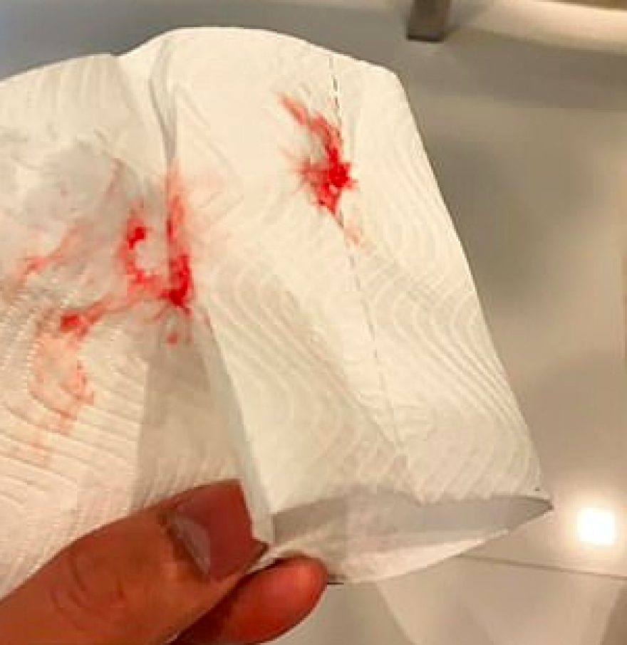 Βυθισμένη στο νέφος η Μπανγκόκ - Οι άνθρωποι βήχουν αίμα εξαιτίας της ρύπανσης