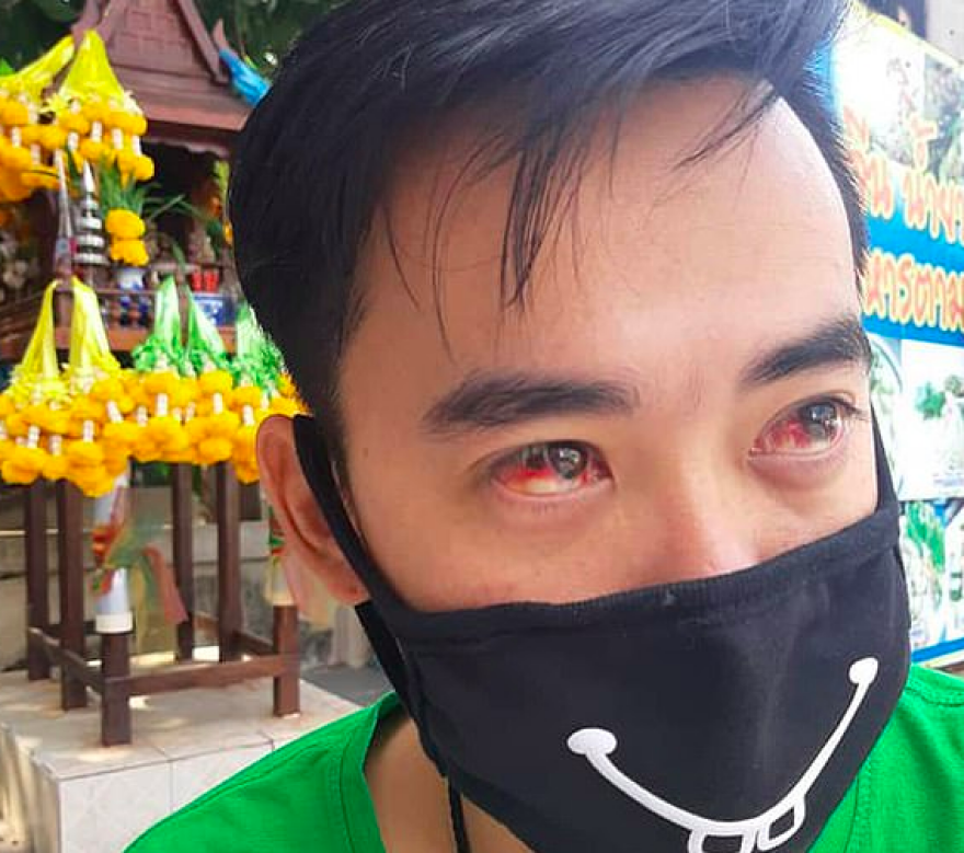 Βυθισμένη στο νέφος η Μπανγκόκ - Οι άνθρωποι βήχουν αίμα εξαιτίας της ρύπανσης