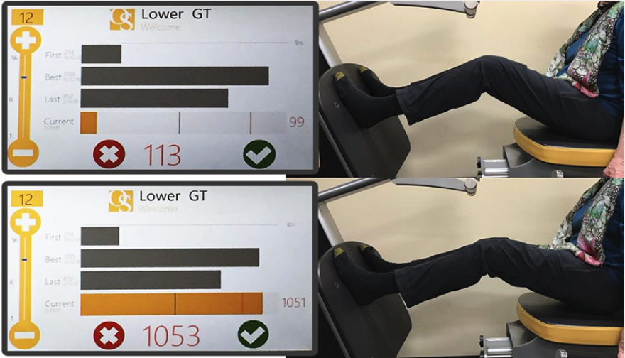 Οστεοπόρωση: Μάθε για τα 4 βήματα που υπόσχονται να σου αλλάξουν τη ζωή