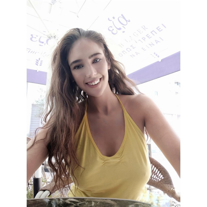 Μοντέλο αποκάλυψε ότι έπεσε θύμα ξυλοδαρμού από τον πρώην σύντροφό της