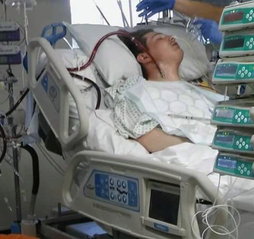 Βρετανία: Ενας έφηβος παραλίγο να πεθάνει λόγω ατμίσματος - Κατέρρευσαν μέσα σε μήνες οι πνεύμονές του