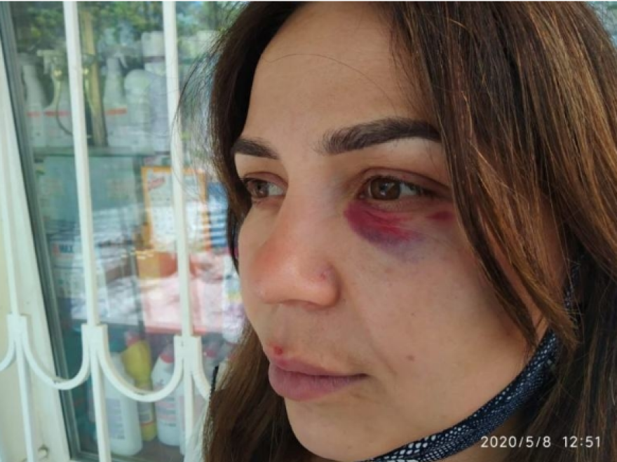 Κριμαία: Προπονητής πολεμικών τεχνών έφτυσε και έδειρε πωλήτρια που του ζήτησε να βάλει μάσκα