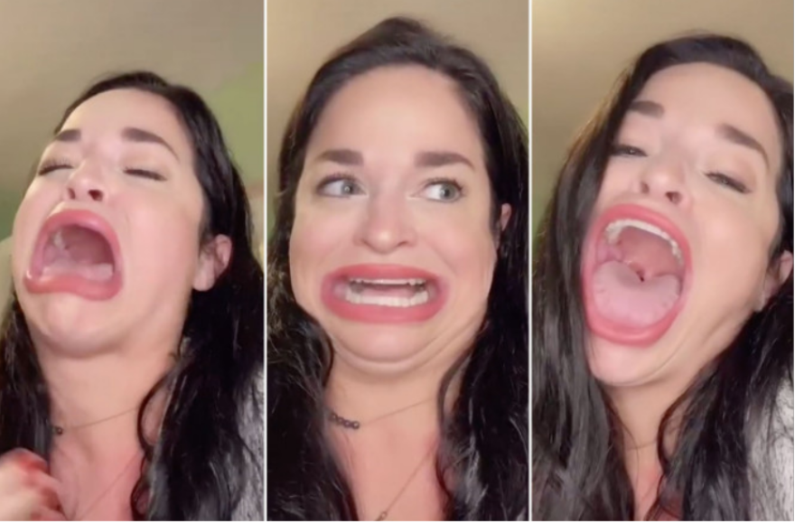 To τεράστιο στόμα της την έκανε διάσημη στο TikTok - Δείτε βίντεο 