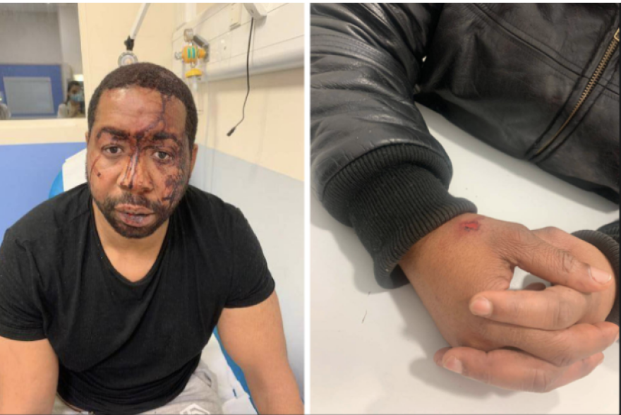 Παρίσι: Σάλος με βίντεο άγριου ξυλοδαρμού μαύρου από αστυνομικούς - «Με φώναζαν βρωμοαράπη»