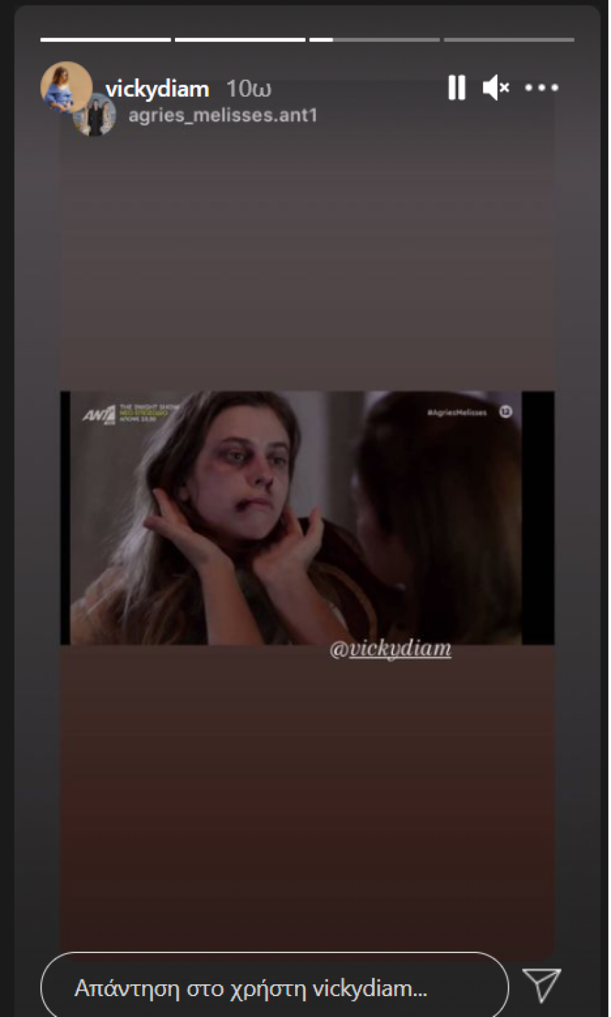 Άγριες Μέλισσες: Το αληθοφανές μακιγιάζ της κακοποιημένης Σοφούλας - Φωτογραφίες