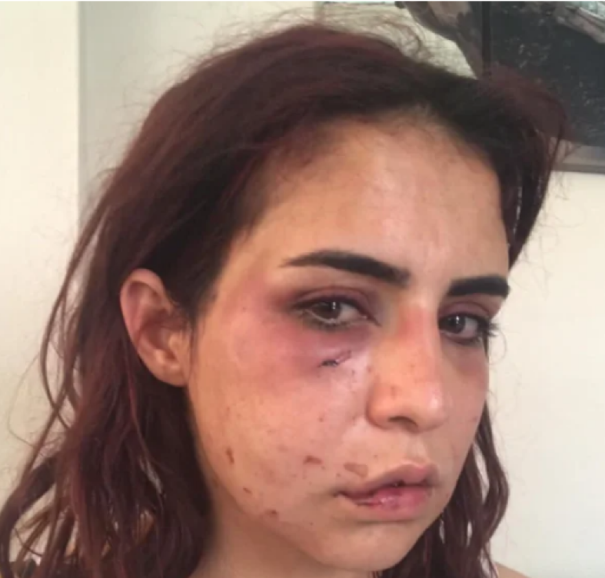 Τούρκος έδειρε μέχρι λιποθυμίας την ερωμένη του σε βιντεοκλήση με τη γυναίκα του