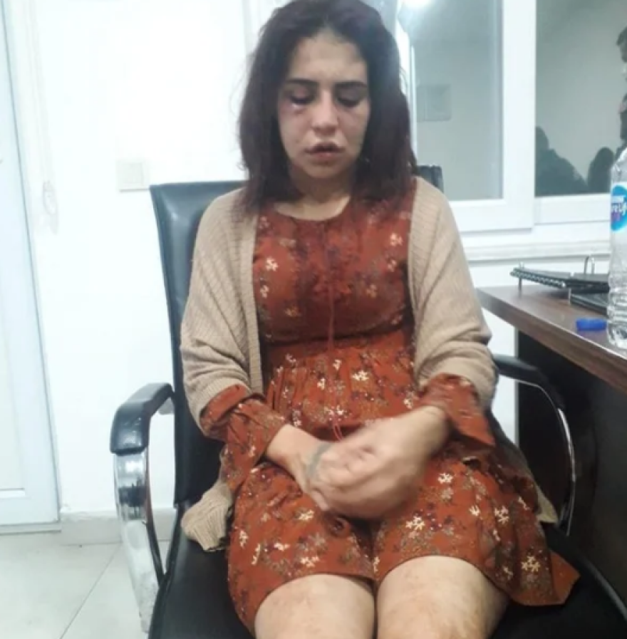 Τούρκος έδειρε μέχρι λιποθυμίας την ερωμένη του σε βιντεοκλήση με τη γυναίκα του