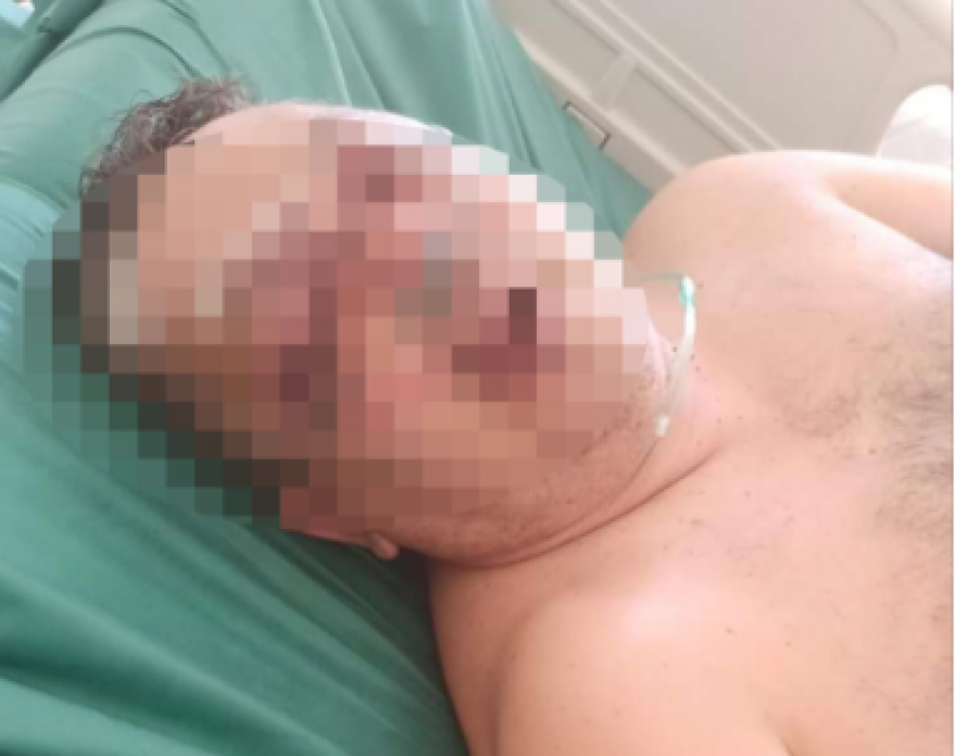 Συγκλονίζει ο αστυνομικός που έπεσε θύμα άγριας επίθεσης: Με χτυπούσε αλύπητα με σιδερολοστό ο αγρότης