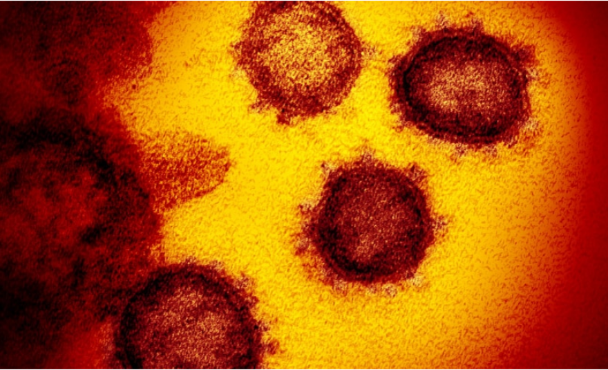 Η επιδημία του κορωνοϊού ξέσπασε στην Ανατολική Ασία πριν από περίπου 25.000 χρόνια, σύμφωνα με επιστημονικές μελέτες 