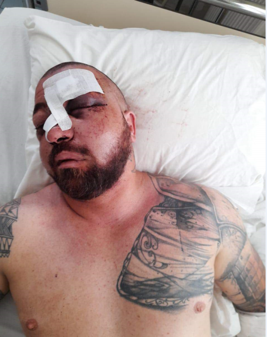 Μύκονος: Το βίντεο-ντοκουμέντο από το κορωνοπάρτι που κατέληξε στον ξυλοδαρμό του σωματοφύλακα