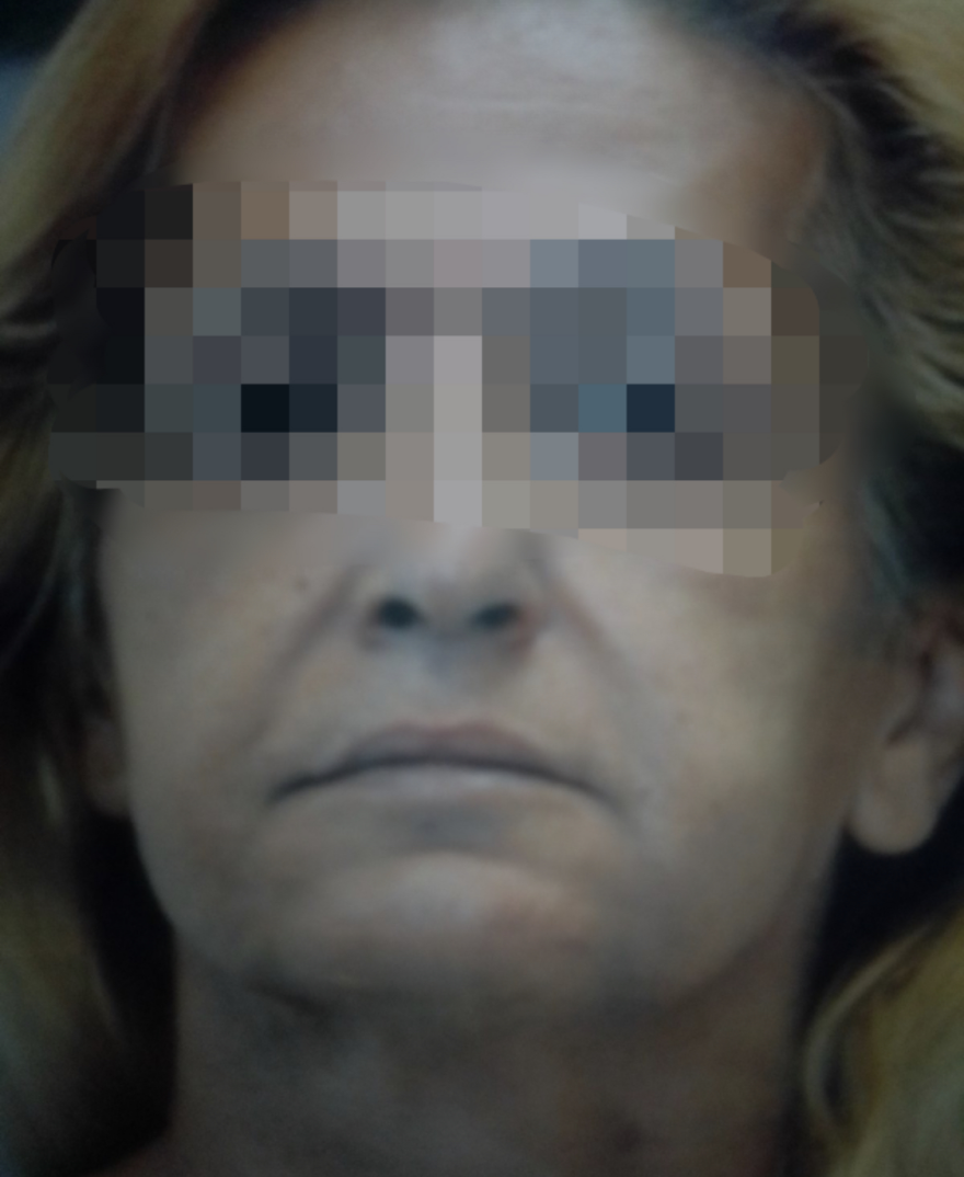 Μεταγωγή-Γολγοθάς για τραβεστί-δολοφόνο των Εξαρχείων