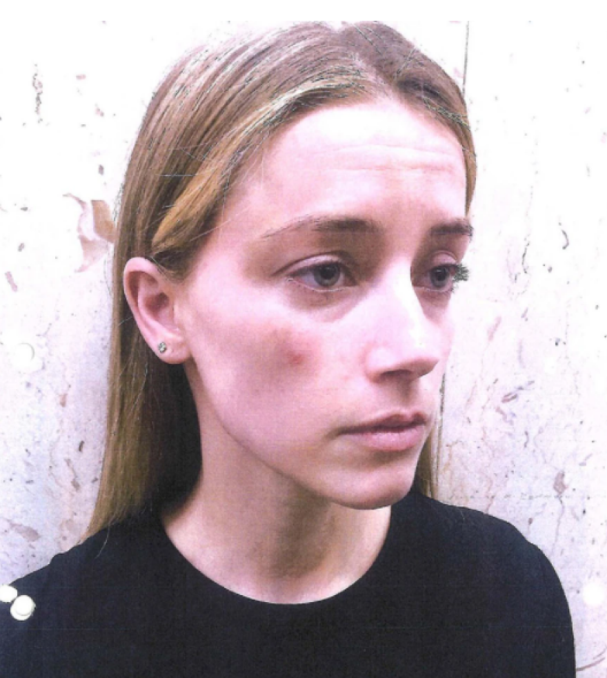 Τζόνι Ντεπ: Αποκτά πλήρη πρόσβαση στα τηλεφωνικά αρχεία της Χερντ, προκειμένου να αποδείξει την αθωότητά του 