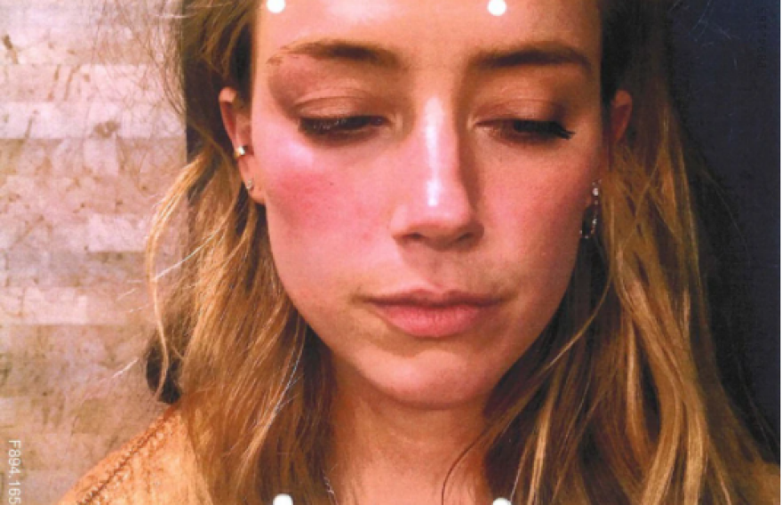 Τζόνι Ντεπ: Αποκτά πλήρη πρόσβαση στα τηλεφωνικά αρχεία της Χερντ, προκειμένου να αποδείξει την αθωότητά του 