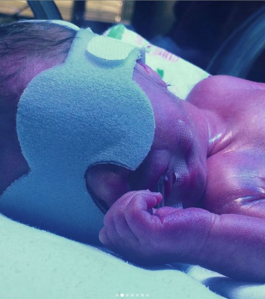 Ρούλα Ρέβη: Οι φωτογραφίες που ανέβασε από τα πρόωρα μωρά της