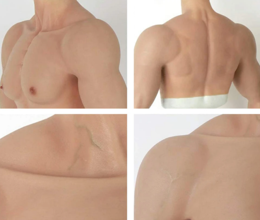 Ο Ιταλός που έβαλε ψεύτικο χέρι για να αποφύγει το εμβόλιο λέει τώρα ότι τον... κατέστρεψαν οι δημοσιογράφοι!