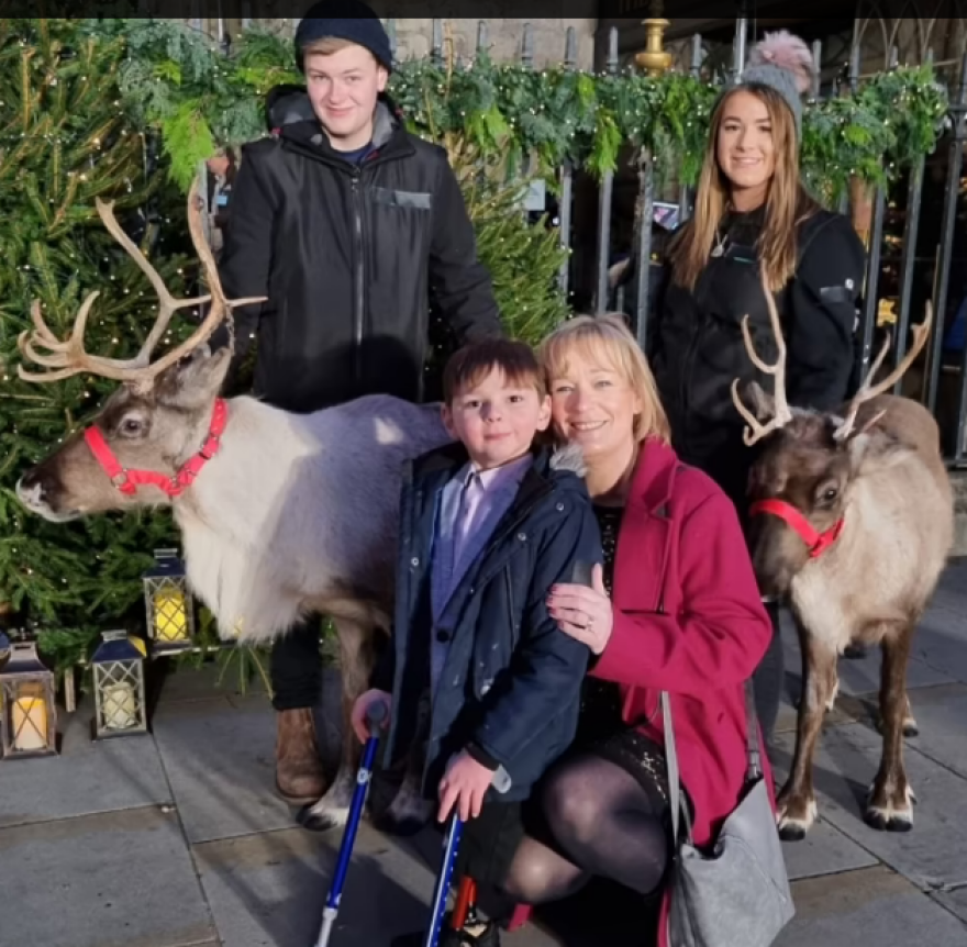 Συγκλονίζει η ιστορία του 7χρονου Τόνι: Έχασε τα δύο του πόδια επειδή τον κακοποιούσαν οι γονείς του 