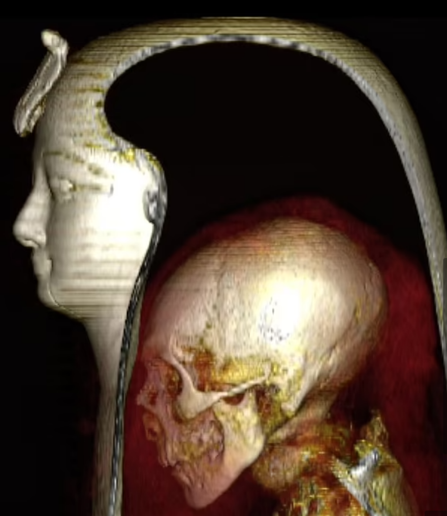 Τι αποκάλυψε το ψηφιακό «ξετύλιγμα» της μούμιας του Φαραώ Αμένοφι Α'