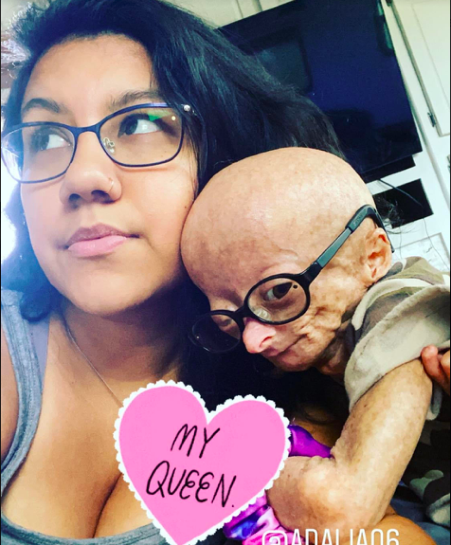 Σταρ του YouTube που έπασχε από τη νόσο «Benjamin Button» πέθανε σε ηλικία 15 ετών