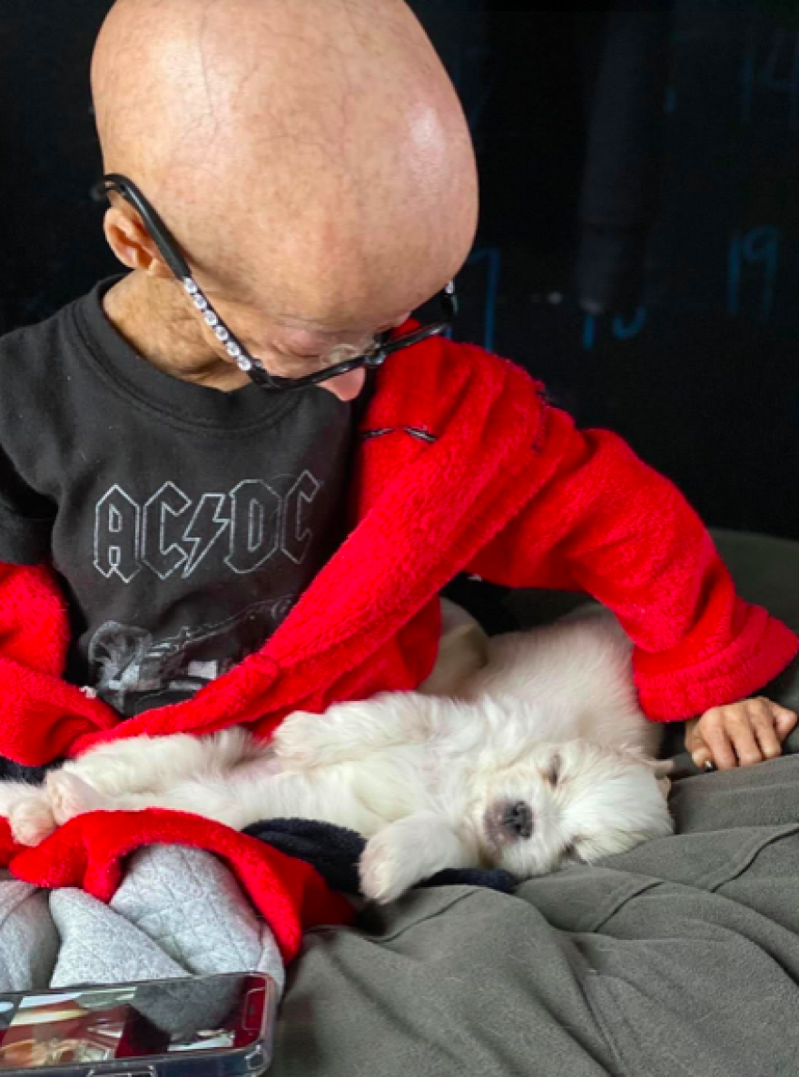 Σταρ του YouTube που έπασχε από τη νόσο «Benjamin Button» πέθανε σε ηλικία 15 ετών