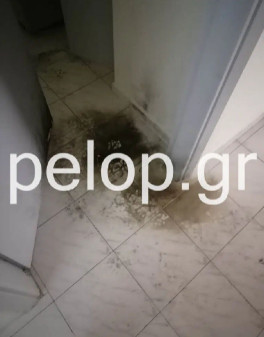 Πάτρα - 20χρονη καταγγέλλει τον σύζυγό της: Ήρθε στο σπίτι, δυνάμωσε τη μουσική και άρχισε να με χτυπάει