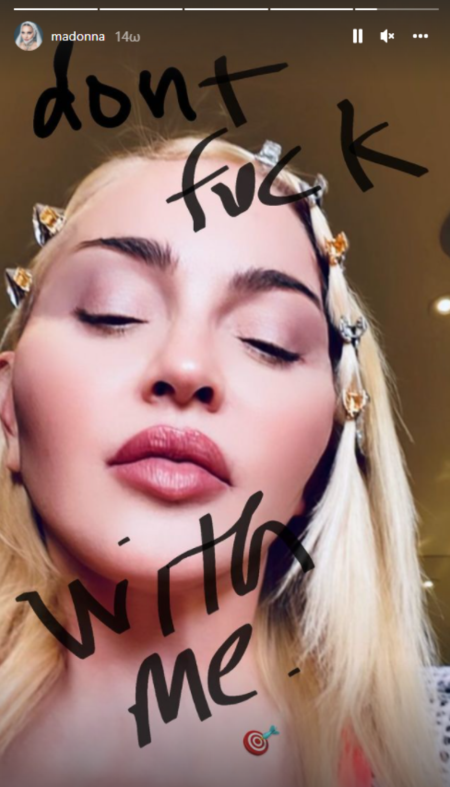 Η Μαντόνα... το παράκανε με τα φίλτρα στο Instagram και απαντά στους «haters»: Μην τα βάζετε μαζί μου!