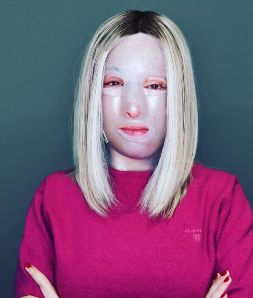 Αννίτα Ναθαναήλ: «Το τελευταίο χειρουργείο της Ιωάννας Παλιοσπύρου δεν πήγε καλά»