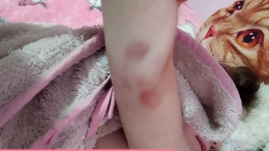 Θάνατος τριών παιδιών στην Πάτρα: Φωτογραφία - ντοκουμέντο με μελανιές στο χέρι της Τζωρτζίνας - Τι λένε συγγενείς 