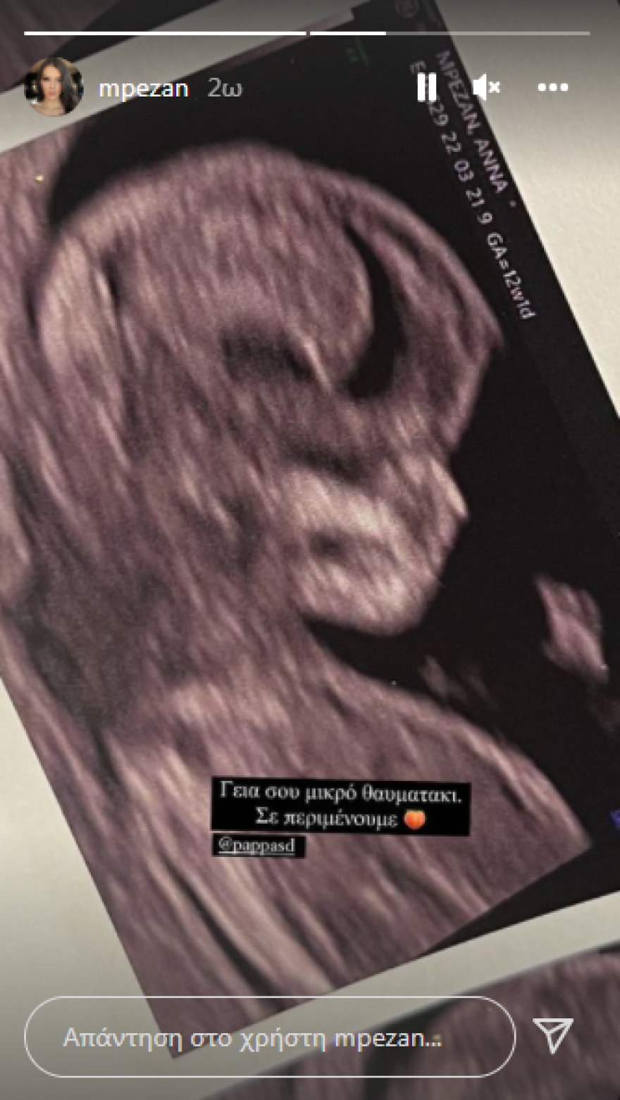 Άννα Μπεζάν: Η φωτογραφία από το υπερηχογράφημα του μωρού που περιμένει με τον Δημήτρη Παππά