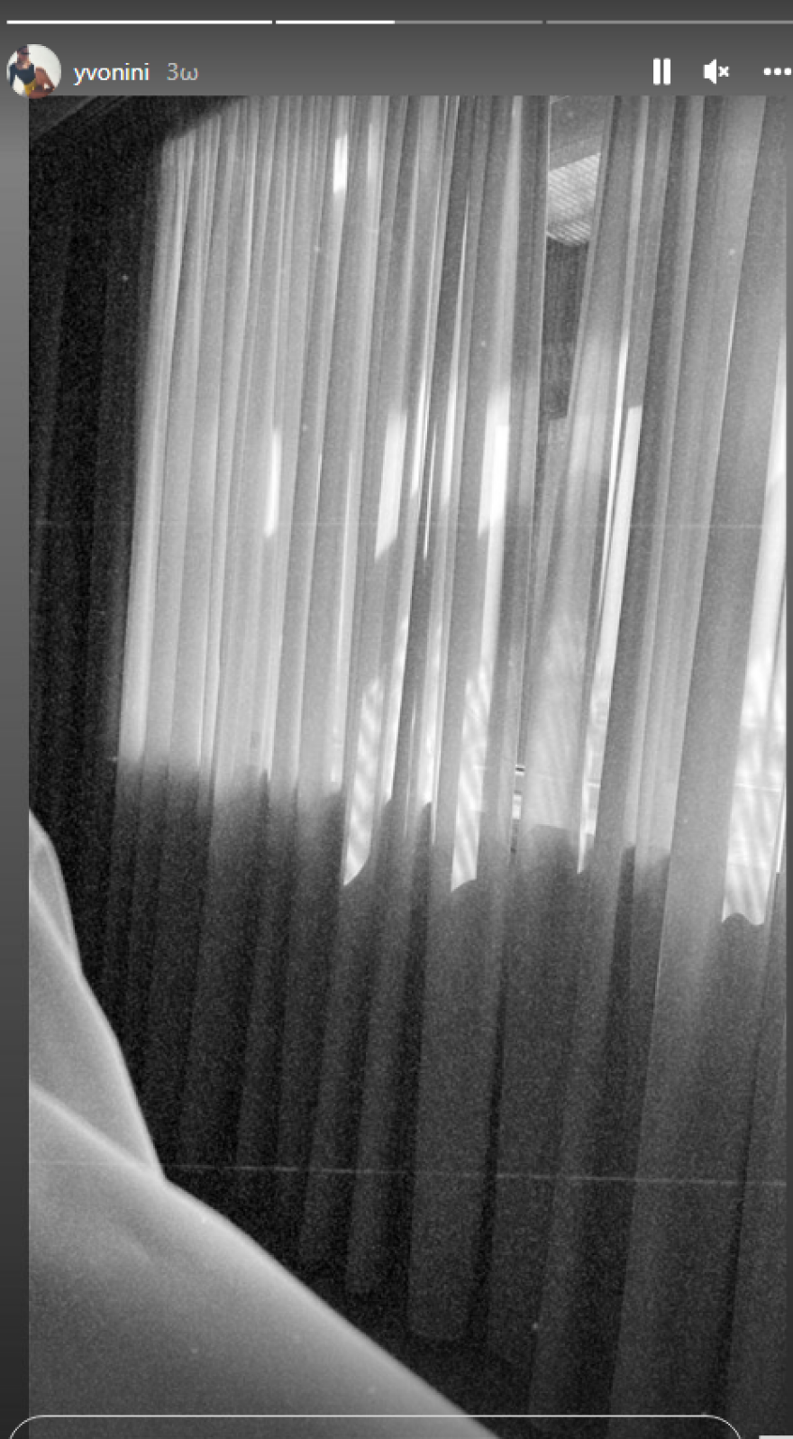 Υβόννη Μπόσνιακ: Στο νοσοκομείο η σύζυγος του Αντώνη Ρέμου