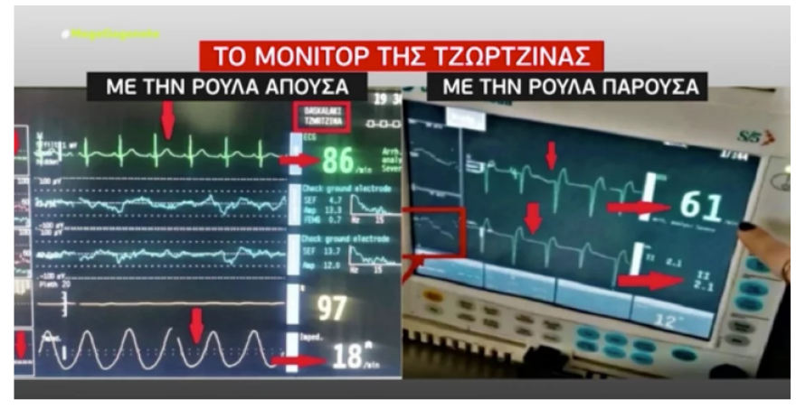 Ρούλα Πισπιρίγκου: Μόνιτορ, επεισόδια και αναισθητικά στο στόχαστρο των ερευνών