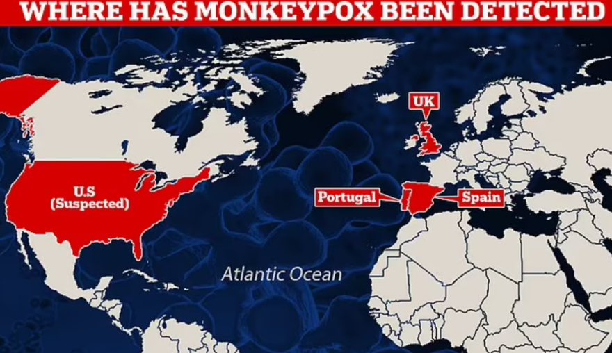 Ανησυχία στην Ευρώπη: Η «ευλογιά των πιθήκων» εξαπλώνεται στην Γηραιά Ήπειρο