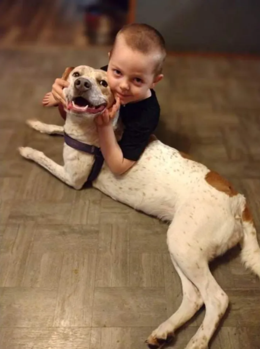 Ένα πεντάχρονο παιδί έχασε το χαμόγελό του μετά από επίθεση του σκύλου του - Προσοχή σκληρές εικόνες