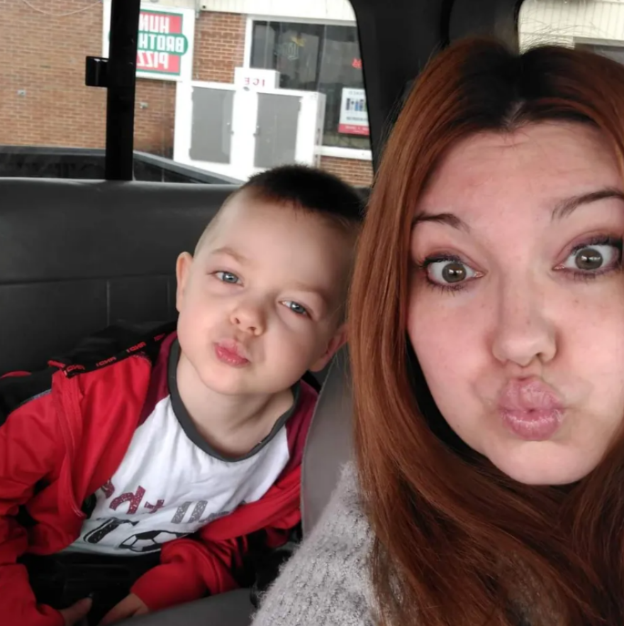 Ένα πεντάχρονο παιδί έχασε το χαμόγελό του μετά από επίθεση του σκύλου του - Προσοχή σκληρές εικόνες