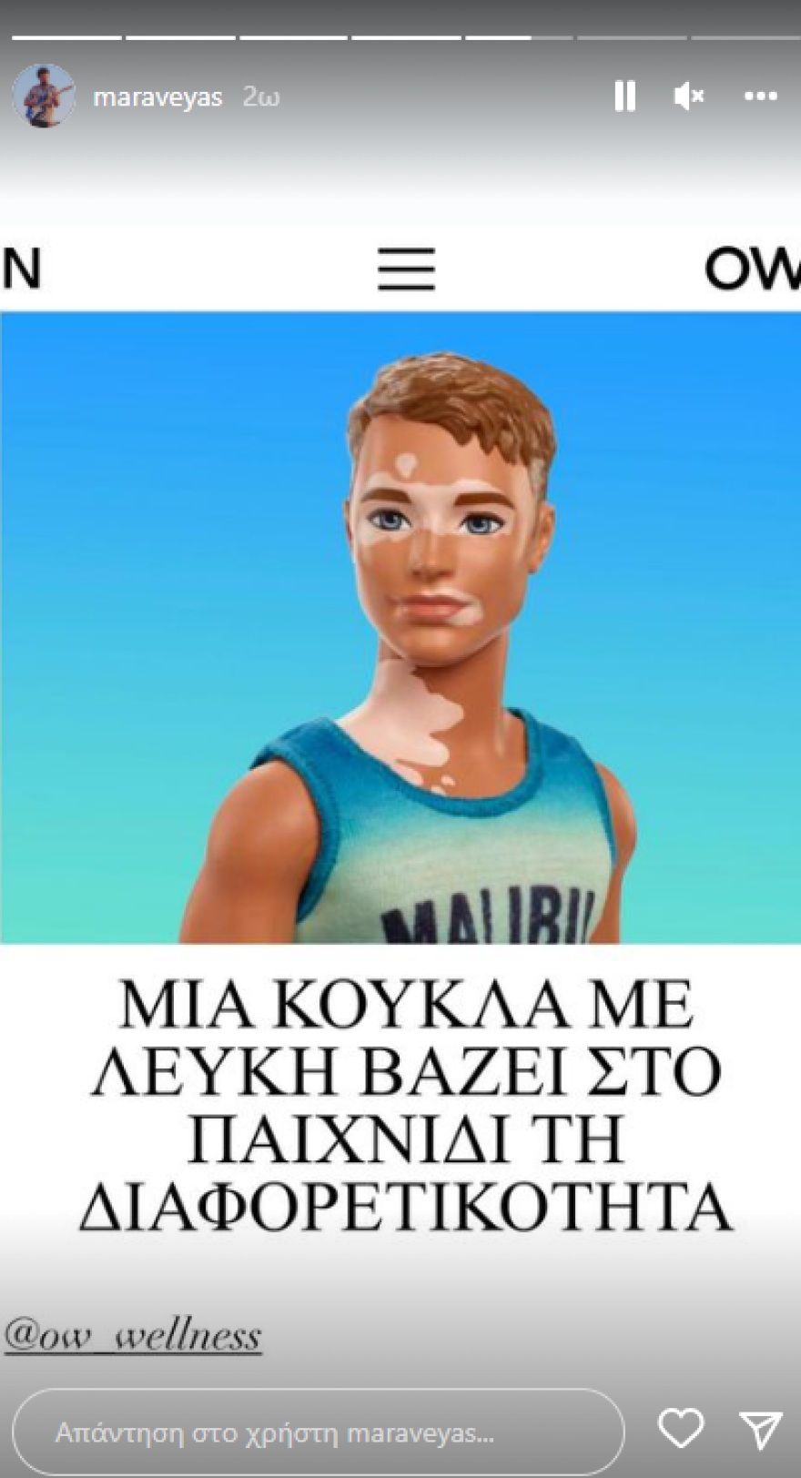 Ο Κωστής Μαραβέγιας δείχνει τα σημάδια της λεύκης στα χέρια του και περνά το μήνυμά του