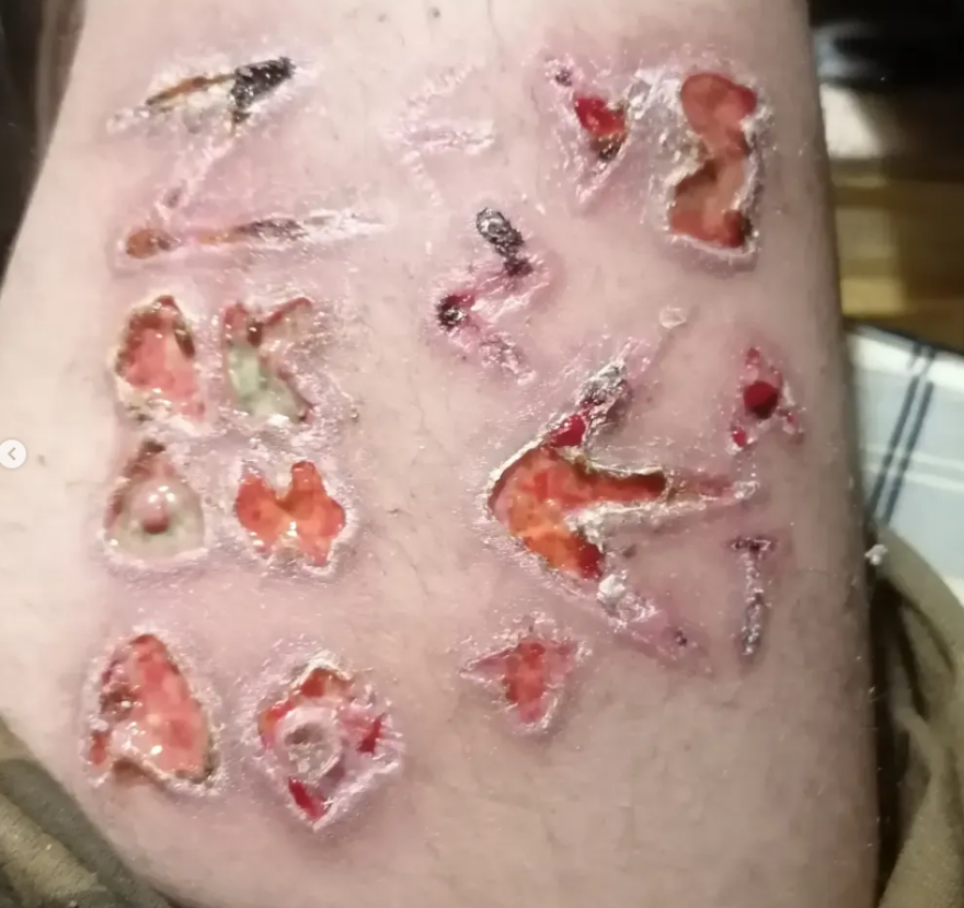 Σύνταγμα: «Θα σας κόβω τα κεφάλια ένα ένα», είχε γράψει στα social media πριν πάει ένοπλος στον Άγνωστο Στρατιώτη 