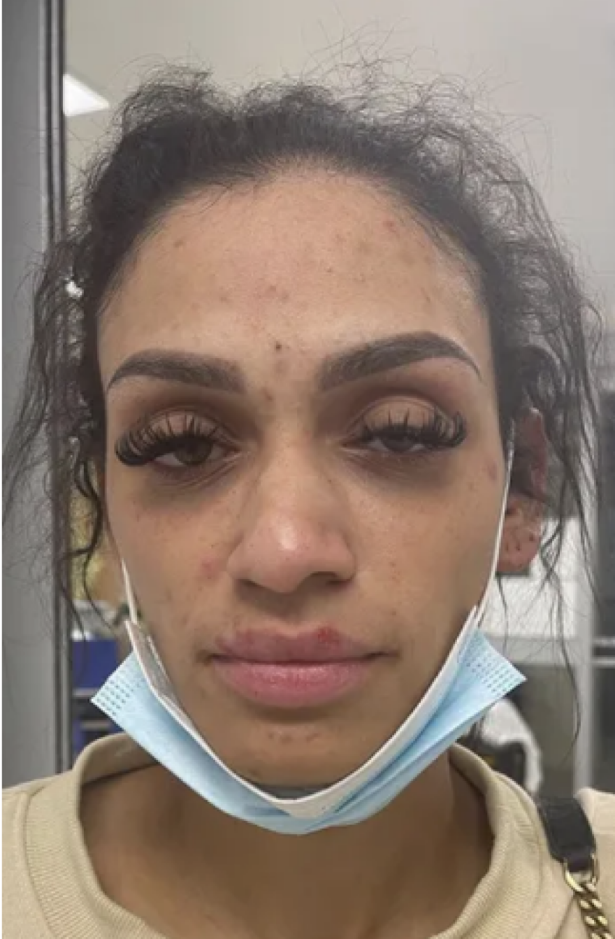 Μάιλς Μπρίτζες: Αντιμετωπίζει κατηγορία για κακοποίηση ανηλίκου