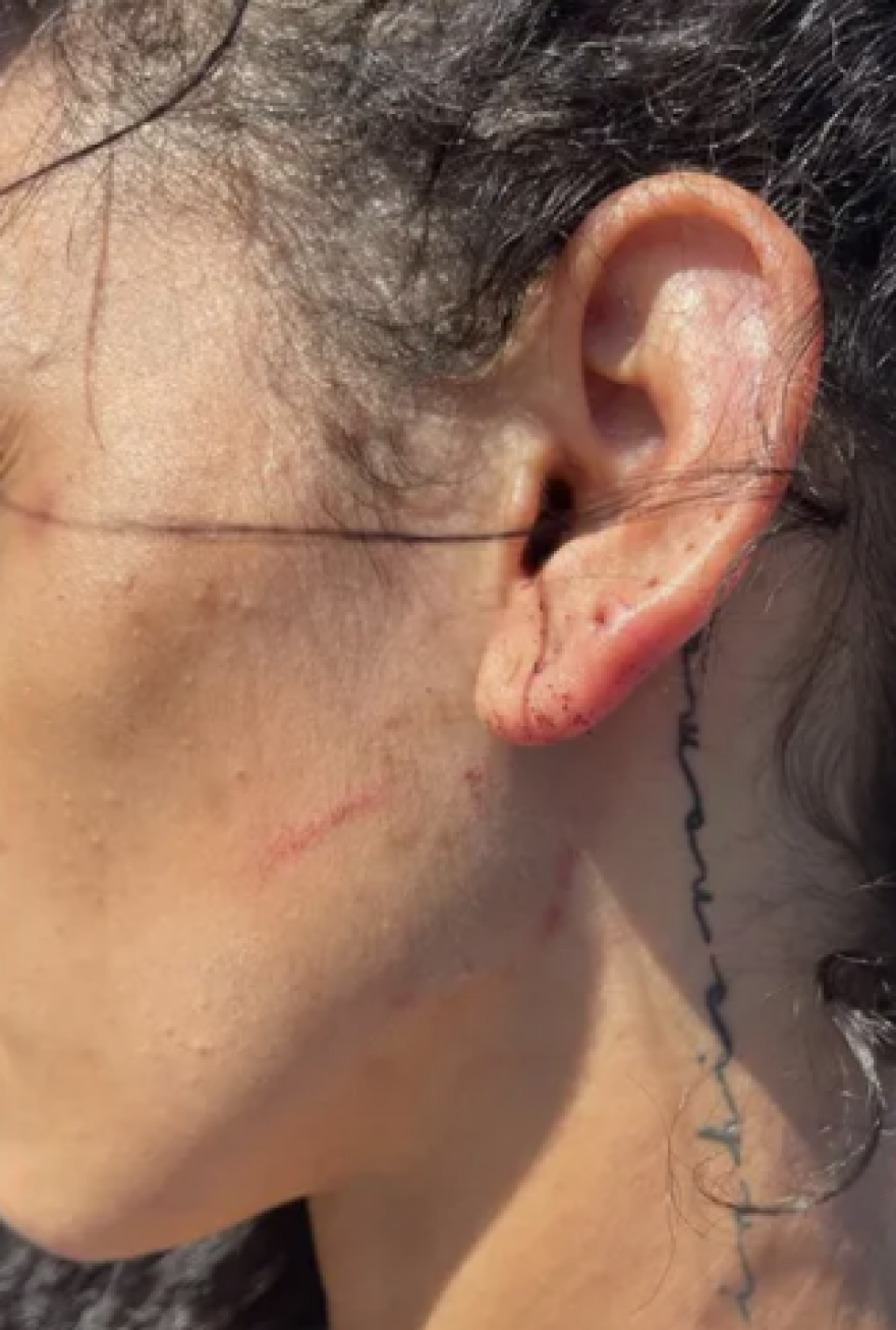 Μάιλς Μπρίτζες: Αντιμετωπίζει κατηγορία για κακοποίηση ανηλίκου