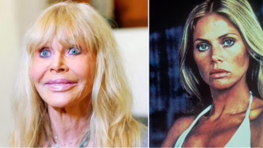 Πέντε διάσημες που μετάνιωσαν για τις πλαστικές που έκαναν