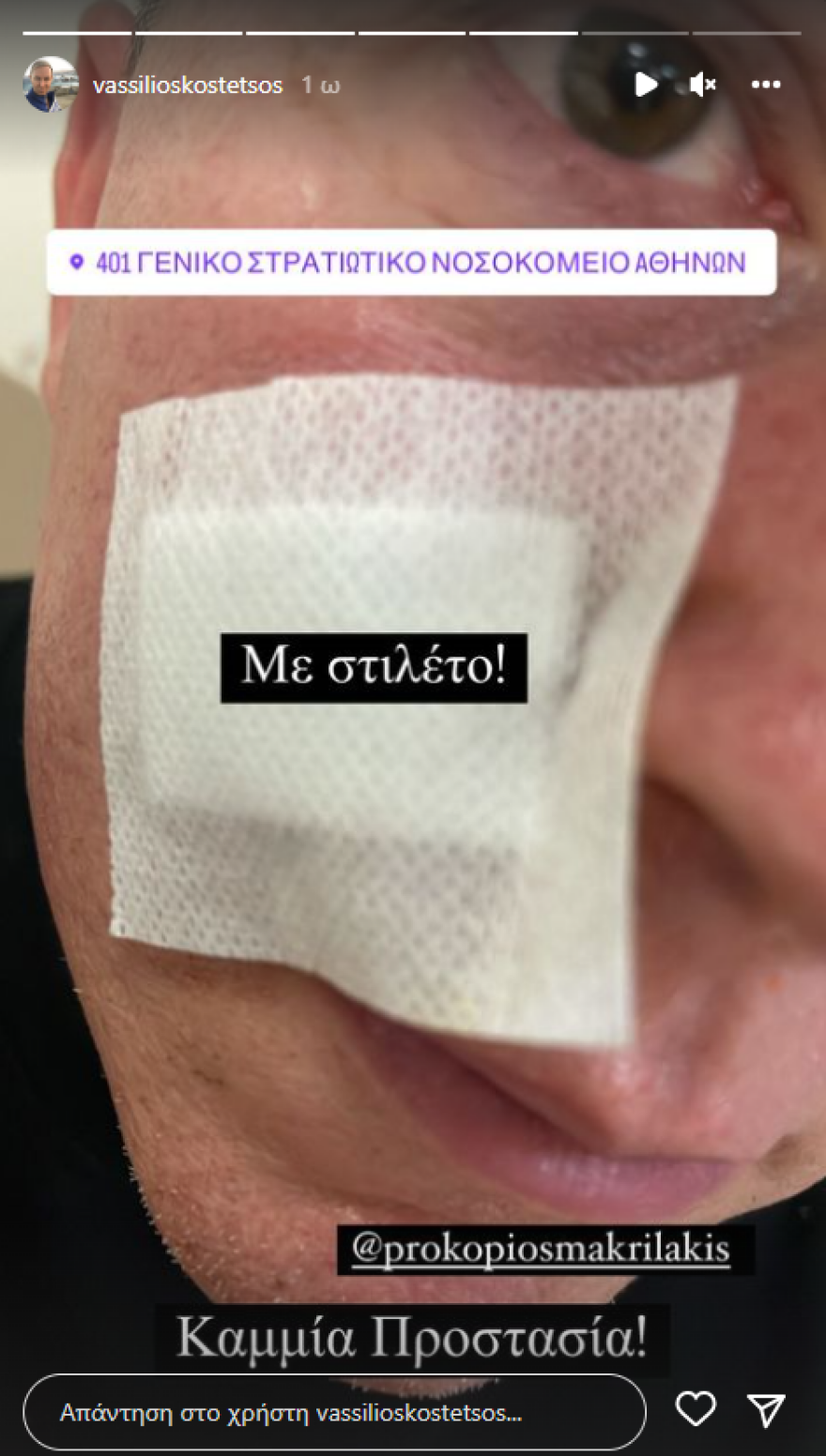 Βασίλειος Κωστέτσος: Αλλοδαποί του επιτέθηκαν στο κέντρο της Αθήνας με σκοπό να τον κλέψουν