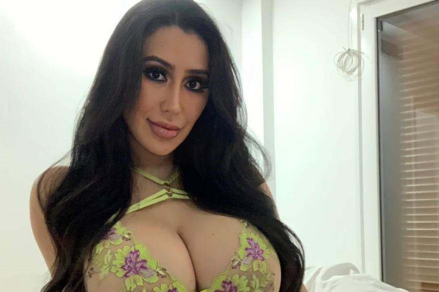 Κιμ Καρντάσιαν: Κορεάτισσα πλήρωσε 70.000 δολάρια σε επεμβάσεις για να της μοιάσει