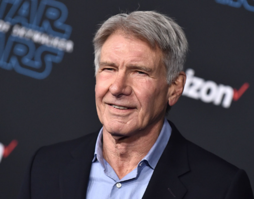 Oι «σημαδεμένοι» του Χόλιγουντ και οι ιστορίες πίσω τις διάσημες ουλές τους