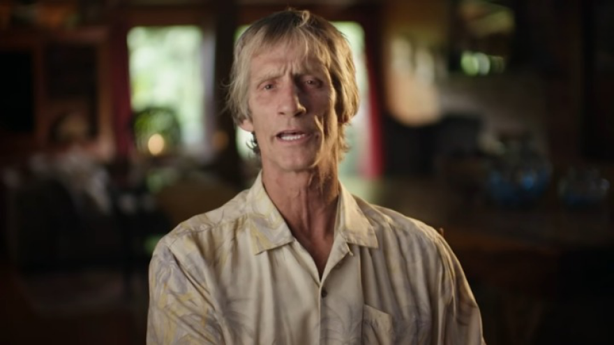 Ζακ Έφρον: Αποκάλυψε ότι κόντεψε να πεθάνει - Πώς κατέληξε αγνώριστος και… παραφουσκωμένος 