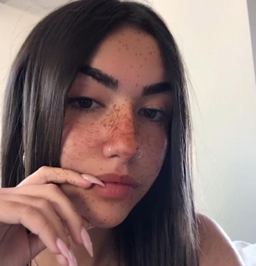 Χαλκίδα: Θρήνος για την 16χρονη που σκοτώθηκε σε τροχαίο