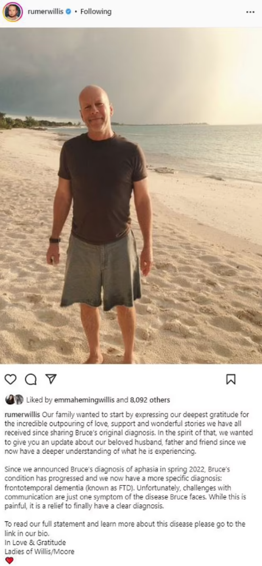 Μπρους Γουίλις: Διαγνώστηκε με μετωποκροταφική άνοια - Ποια είναι τα συμπτώματα