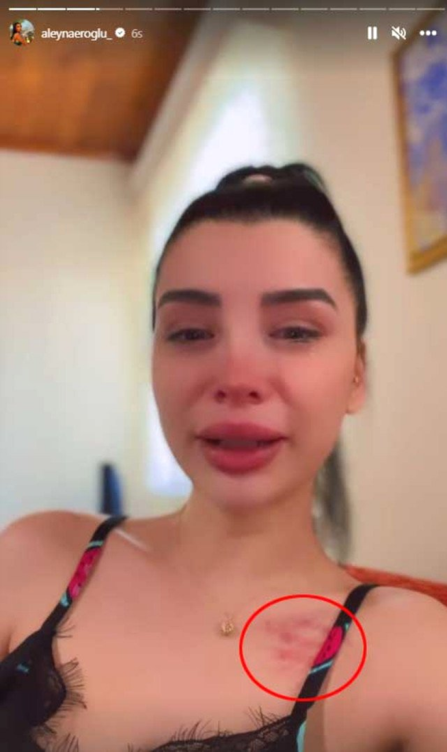 Τουρκάλα καλλονή κατηγορεί για ξυλοδαρμό τον Μπατού Καραντενίζ 