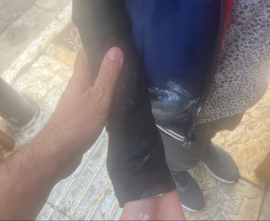 Πετράλωνα - Πλεύρης: Με οίδημα στο μάτι από την επίθεση - Η ανακοίνωση του «Λαϊκού»