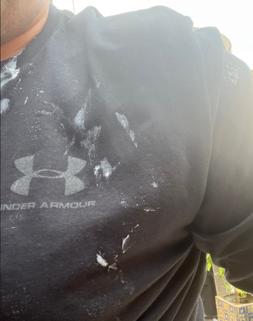 Πετράλωνα - Πλεύρης: Με οίδημα στο μάτι από την επίθεση - Η ανακοίνωση του «Λαϊκού»